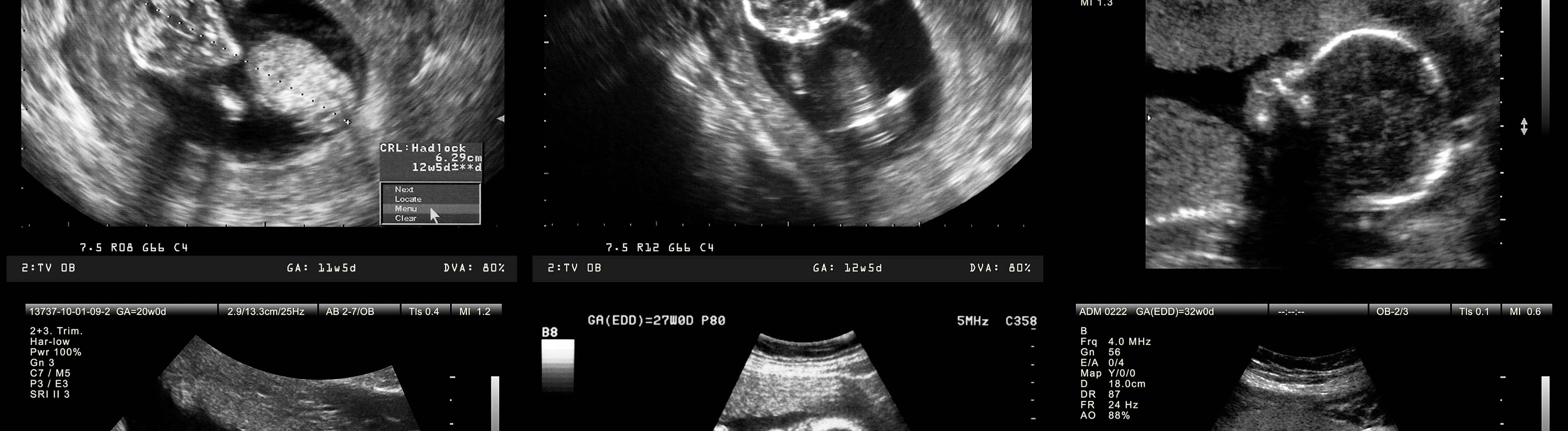 12 Week Pregnancy Symptoms What To Expect In Early Pregnancy Inseminmate 12-week-pregnancy-symptoms-what-to-expect-in-early-pregnancy-inseminmate