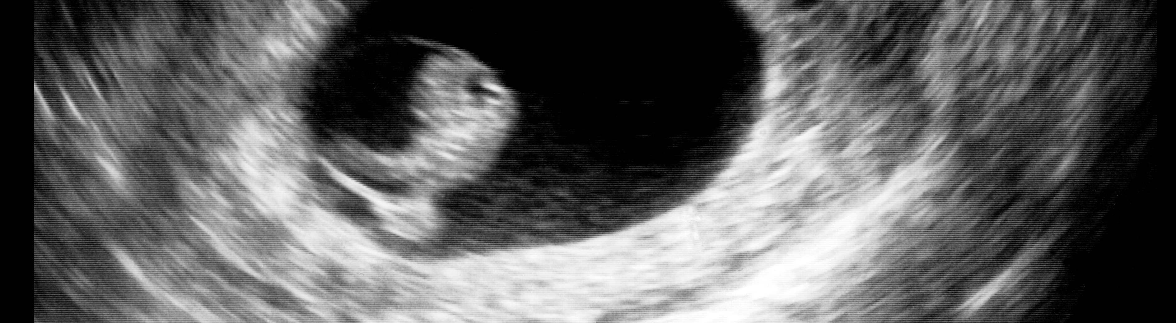 4 Weeks Pregnant Symptoms: What to Expect in Early Pregnancy – Inseminmate